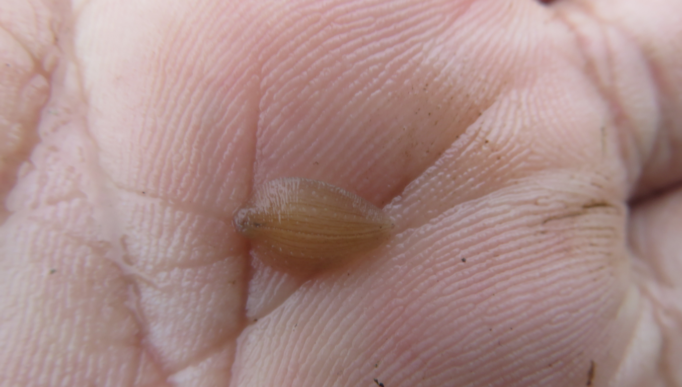 水蛭养殖池里看到的白色的有点儿像小水蛭的虫子是什么？