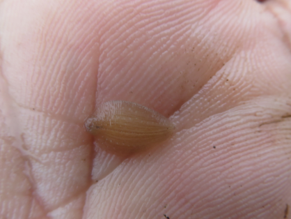 水蛭养殖池里看到的白色的有点儿像小水蛭的虫子是什么?